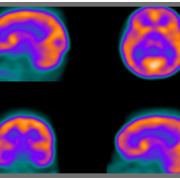 Nuclear Medicine ServiceTrak