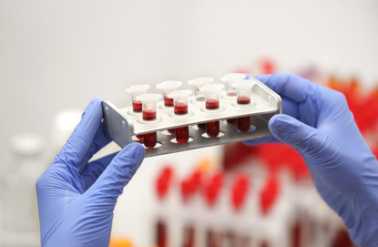 marketing to clinical diagnostic labs